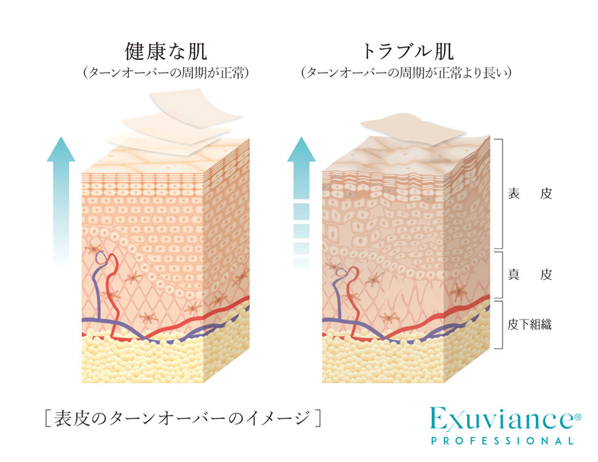 表皮のターンオーバーのイメージ